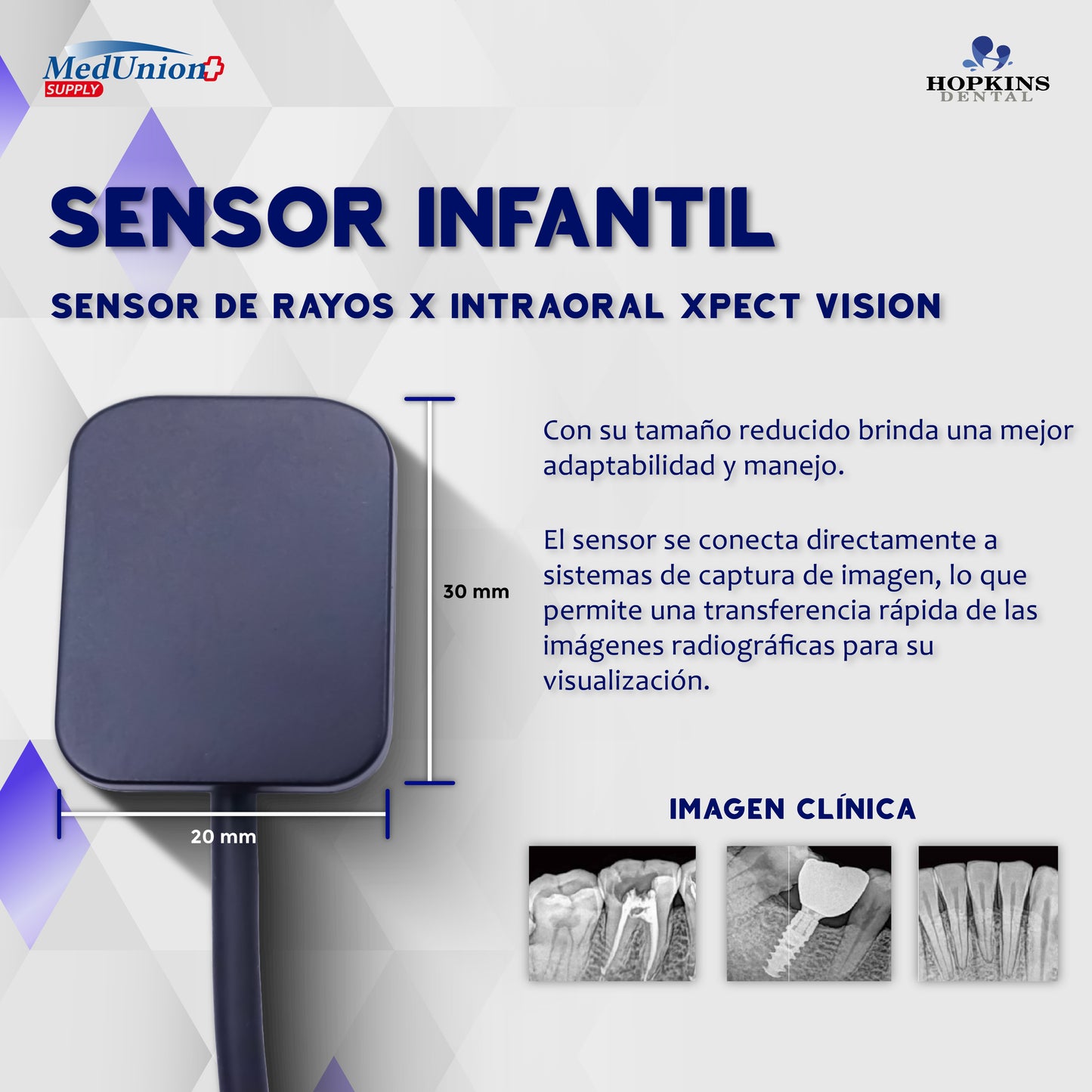 Radiovisografo
